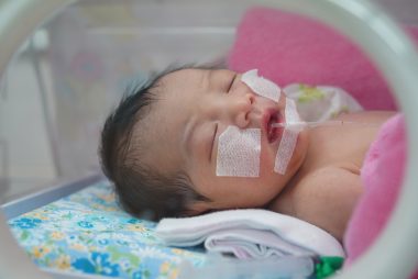newborn in NICU,Neonatal intensive care unit.