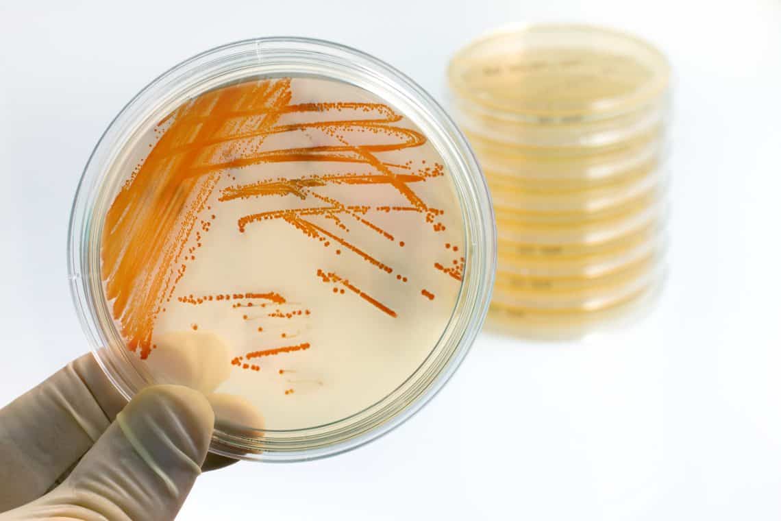 plate with bacterial colonies of Streptococcus agalactiae in culture medium plate